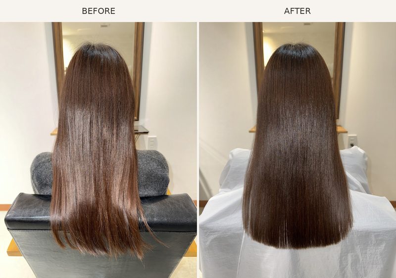 AGATA施術事例2 Before/After