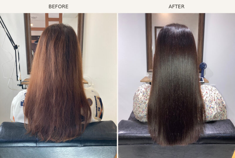 AGATA施術事例3 Before/After