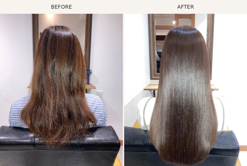 AGATA施術事例4 Before/After