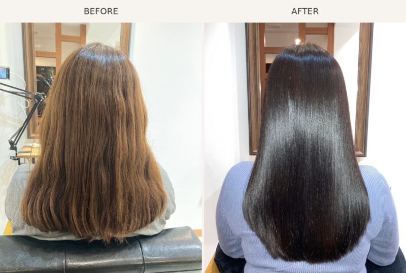 AGATA施術事例5 Before/After