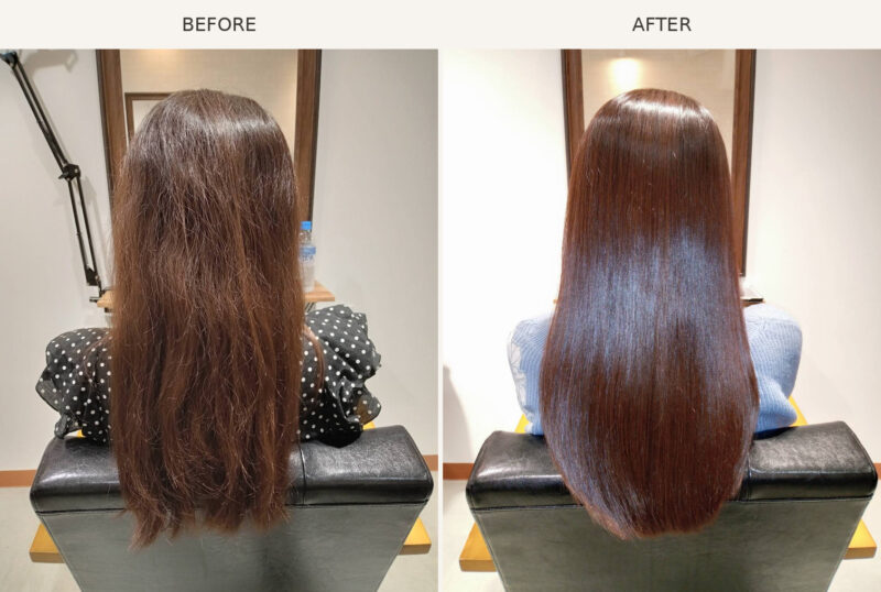 AGATA施術事例6 Before/After