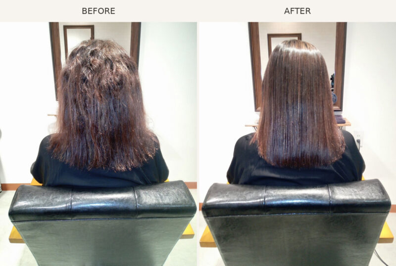 AGATA施術事例7 Before/After