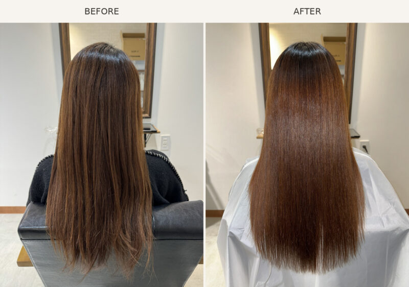 AGATA施術事例8 Before/After
